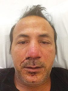 Pakistani Christian Tajamal Amar in hospital, after being beaten up in Derby
