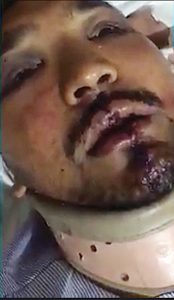 Sajid Masih makes his statement to his solicitor from his hospital bed