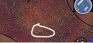 Injected proof - Dr PvW - no 4