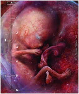 Foetus alive in the uterus 10 weeks after fertilisation