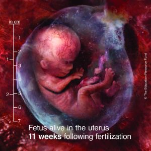 Foetus alive in the uterus 11 weeks after fertilisation
