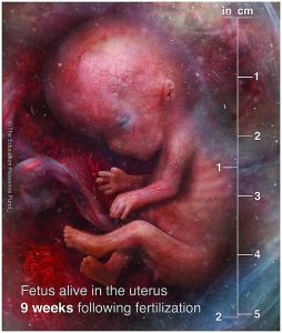 Foetus alive in the uterus 9 weeks after fertilisation