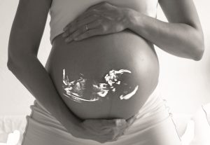 Ultrasound picture of baby on pregnant belly
